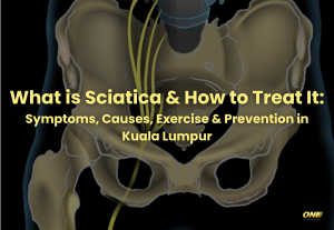 What is Sciatica & How to Treat It Symptoms, Causes, Exercise & Prevention in Kuala Lumpur