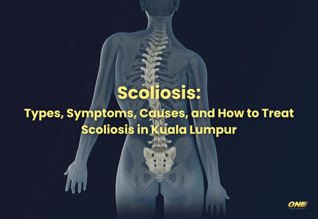 Scoliosis Types, Symptoms, Causes, and How to Treat Scoliosis in Kuala Lumpur