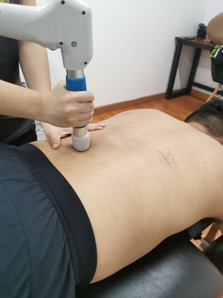 Shockwave therapy ONI Mont Kiara