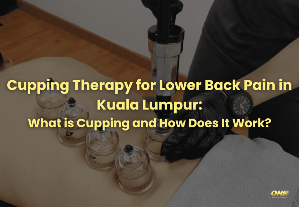 Cupping Therapy for Lower Back Pain in Kuala Lumpur: What is Cupping and How Does It Work?