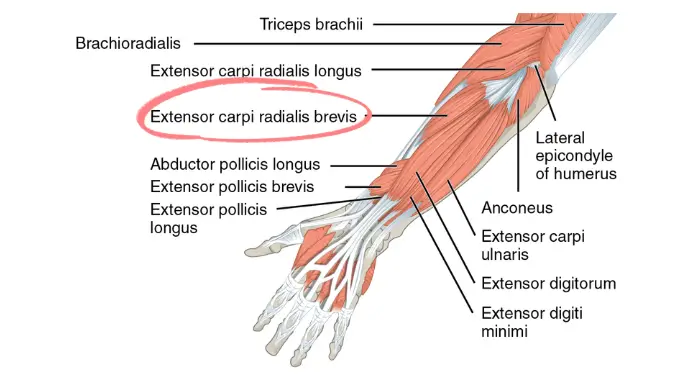Extensor Carpi radialis brevis
