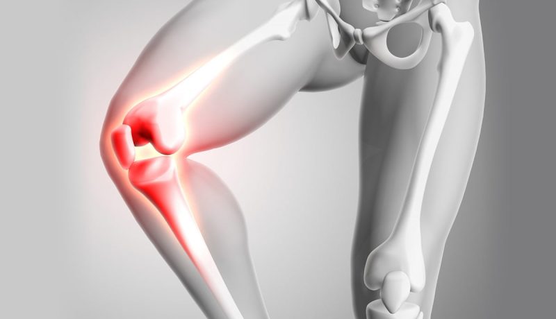 Knee-Pain-Treatment