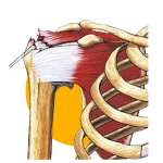 Rotator cuff injury physiotherapy Mont Kiara Rotator cuff injury physiotherapy Mont Kiara