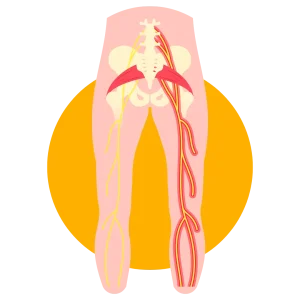 Sciatica Sciatica